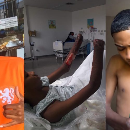 Ele Perdeu as Mãos, Mas Nunca Perdeu o Sorriso: A História de Toquinho